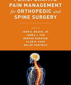 Perioperative Pain Management for Orthopedic and Spine Surgery (PDF)