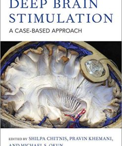 Deep Brain Stimulation: A Case-based Approach (PDF)