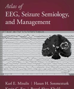 Atlas of EEG, Seizure Semiology, and Management, 3rd Edition (PDF)