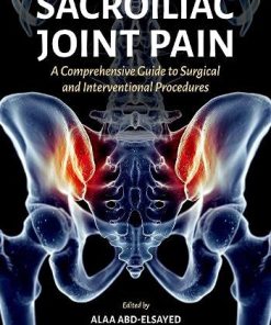 Sacroiliac Joint Pain: A Comprehensive Guide to Interventional and Surgical Procedures (PDF)