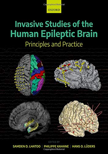 Invasive Studies of the Human Epileptic Brain: Principles and Practice Invasive Studies of the Human Epileptic Brain: Principles and Practice