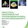 Practical Perioperative Transoesophageal Echocardiography (Oxford Clinical Imaging Guides), 3rd Edition (PDF)