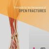 Standards for the Management of Open Fractures (PDF)