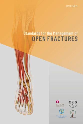 Standards for the Management of Open Fractures (PDF) Standards for the Management of Open Fractures (PDF)