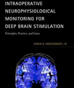 Intraoperative Neurophysiological Monitoring for Deep Brain Stimulation: Principles, Practice and Cases