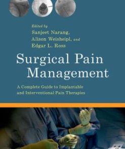 Surgical Pain Management: A Complete Guide to Implantable and Interventional Pain Therapies