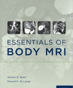 Essentials of Body MRI