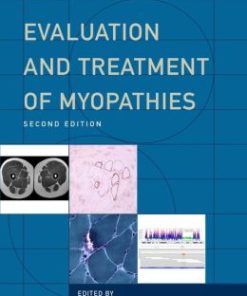 Evaluation and Treatment of Myopathies