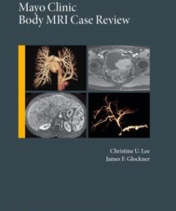 Mayo Clinic Body MRI Case Review