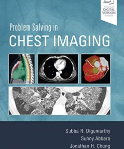 Problem Solving in Chest Imaging (EPUB)