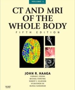 CT and MRI of the Whole Body, 2-Volume Set, 5th Edition (PDF)