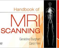 Handbook of MRI Scanning (PDF)