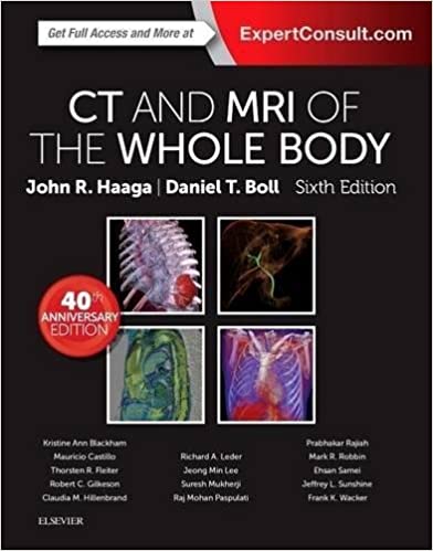 CT and MRI of the Whole Body, 2-Volume Set, 6th Edition (PDF) CT and MRI of the Whole Body, 2-Volume Set, 6th Edition (PDF)