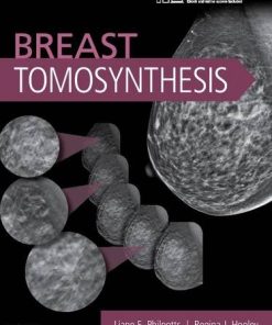 Breast Tomosynthesis (PDF)