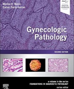 Gynecologic Pathology: A Volume in Foundations in Diagnostic Pathology Series, 2nd Edition (True PDF with ToC + Index)