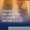 Surgical Implantation of Cardiac Rhythm Devices (Videos Only, Well Organized)