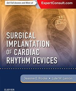 Surgical Implantation of Cardiac Rhythm Devices (Videos Only, Well Organized)