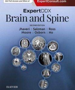 ExpertDDx: Brain and Spine, 2nd Edition (PDF)