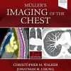 Muller’s Imaging of the Chest: Expert Radiology Series, 2ed (PDF)