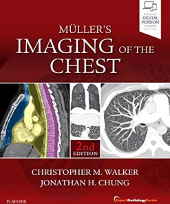 Muller’s Imaging of the Chest: Expert Radiology Series, 2ed (PDF)