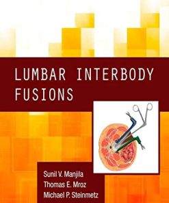 Lumbar Interbody Fusions (PDF)