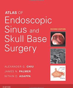 Atlas of Endoscopic Sinus and Skull Base Surgery, 2e (PDF+Videos)