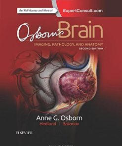 Osborn’s Brain, 2nd Edition (PDF)