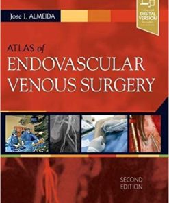 Atlas of Endovascular Venous Surgery, 2nd Edition (PDF)