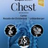 ExpertDDx: Chest (Epub)