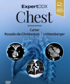 ExpertDDx: Chest (Epub)