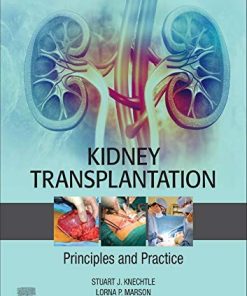 Kidney Transplantation – Principles and Practice, 8th Edition (PDF)