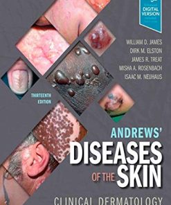 Andrews’ Diseases of the Skin: Clinical Dermatology, 13ed (PDF)