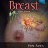 Diagnostic Imaging: Breast, 3rd Edition (PDF)