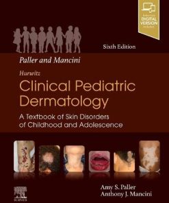 Paller and Mancini – Hurwitz Clinical Pediatric Dermatology: A Textbook of Skin Disorders of Childhood & Adolescence, 6th edition (PDF)