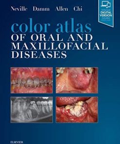 Color Atlas of Oral and Maxillofacial Diseases