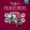 Nolte’s The Human Brain in Photographs and Diagrams, 5th edition (PDF)