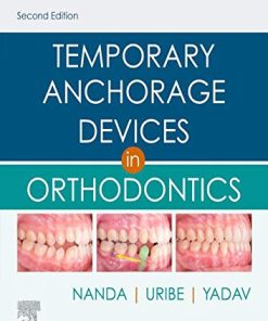 Temporary Anchorage Devices in Orthodontics, 2ed (PDF)