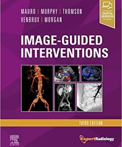 Image-Guided Interventions: Expert Radiology Series, 3rd Edition (True PDF + ToC + Index)