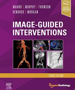 Image-Guided Interventions: Expert Radiology Series, 3ed (PDF)