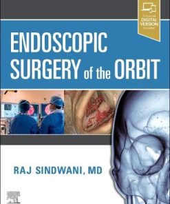 Endoscopic Surgery of the Orbit (PDF)