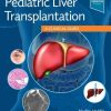 Pediatric Liver Transplantation: A Clinical Guide (True PDF with ToC & Index)