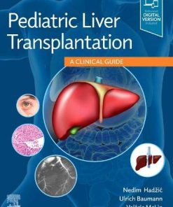 Pediatric Liver Transplantation: A Clinical Guide (True PDF with ToC & Index)