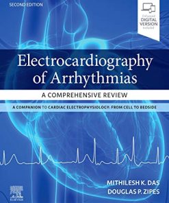 Electrocardiography of Arrhythmias: A Comprehensive Review: A Companion to Cardiac Electrophysiology, 2nd Edition (PDF)