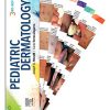 Pediatric Dermatology DDX Deck, 3rd Edition (PDF) Pediatric Dermatology DDX Deck, 3rd Edition (PDF)