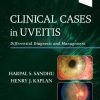 Clinical Cases in Uveitis: Differential Diagnosis and Management (True PDF+ToC+Index)