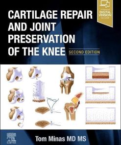 Cartilage Repair and Joint Preservation of the Knee, 2nd Edition (PDF)