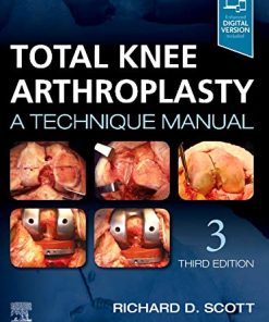 Total Knee Arthroplasty: A Technique Manual, 3rd edition (PDF)