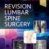 Revision Lumbar Spine Surgery (PDF)