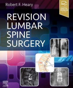 Revision Lumbar Spine Surgery (PDF)