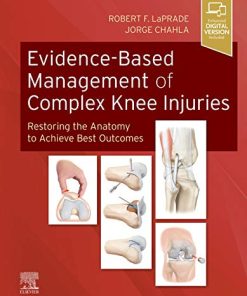 Evidence-Based Management of Complex Knee Injuries: Restoring the Anatomy to Achieve Best Outcomes (PDF)